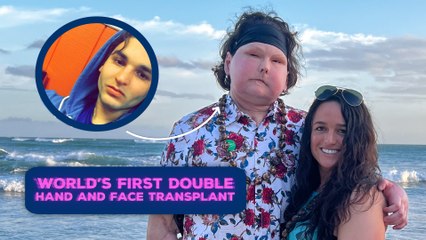 Man in car accident receives WORLD's FIRST face and double hand transplant ❤️