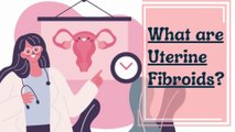 Uterine Fibroids 