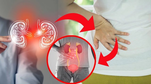 Kidney Infection Kyu Hota Hai, Kidney Infection Reasons And Symptoms | Boldsky