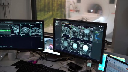 Badanie rezonansem magnetycznym: Co warto wiedzieć przed wizytą? Poznajcie odpowiedzi na najczęstsze pytania