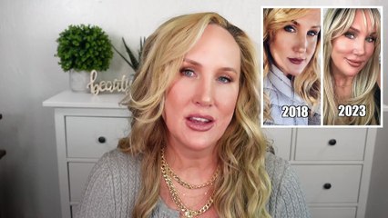 Five Years of DIY Facial Rejuvenation // All the Details!