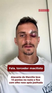 Atacante do Marcílio leva 10 pontos no rosto e fica com olho roxo após joelhada