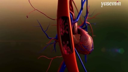 Son zamanlarda büyük artış görüldü! Genç yaşlarda kalp krizi görülme nedenleri nedir?