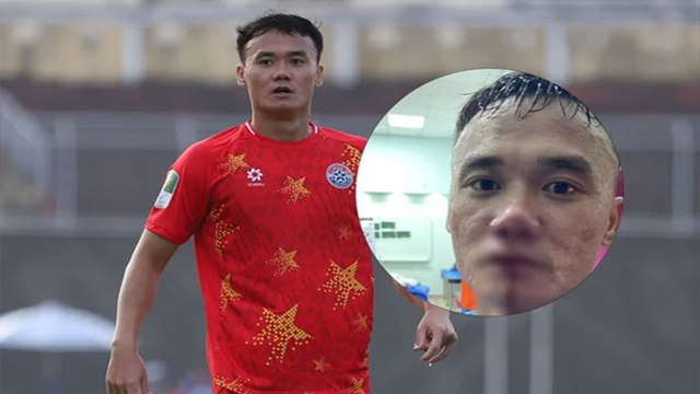 Dạy dỗ đàn ông, Tiền đạo Nguyễn Xuân Nam bị đấm chảy máu mũi