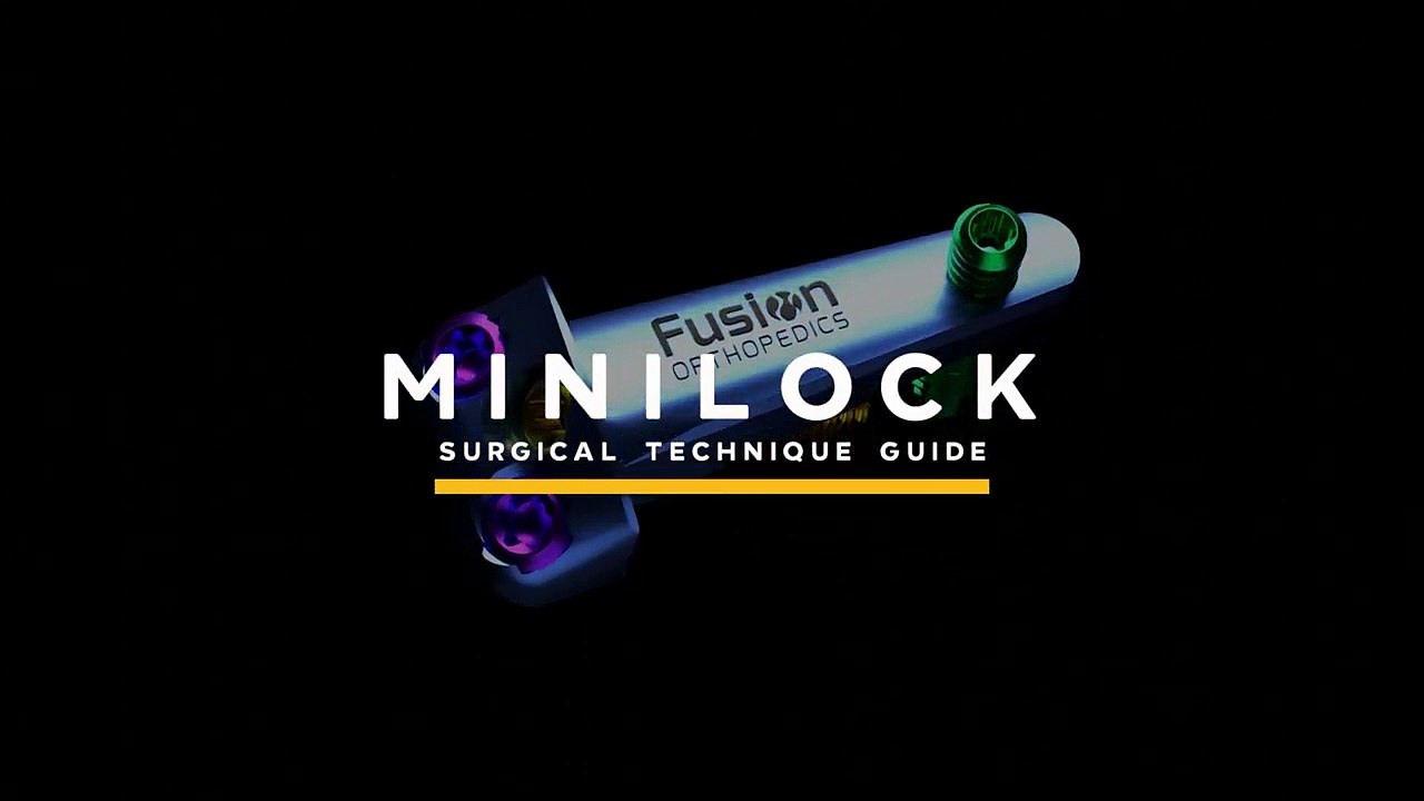 Best minilock service provider in USA