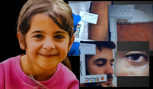 Narin Güran cinayeti soruşturmasında Enes Güran'ın kolundaki izlerin görüntüleri ortaya çıktı
