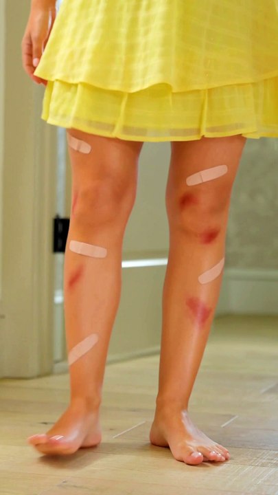 ulik IPL Hair Removal 101