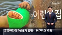 어린이집 훈육에 3살 아동 전치 14주 골절…영구 장애 우려