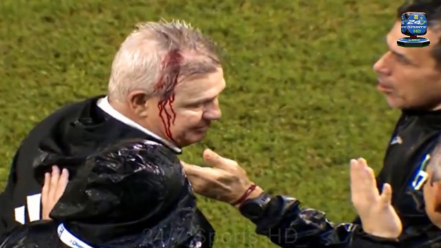Mexico Manager Left with Blood Pouring Down Face After Being Hit with Beer Can Thrown From Crowd
