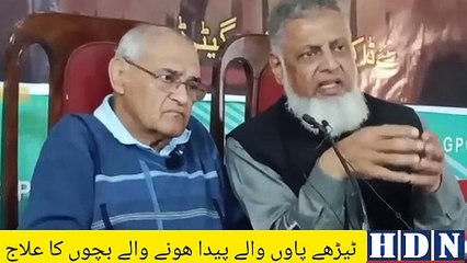 Children born with crooked feet will now be treated in Gujarat as well | hdn