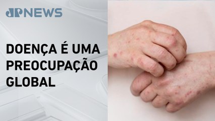 Mais de 1,5 mil casos de Mpox foram registrados no Brasil em 2024