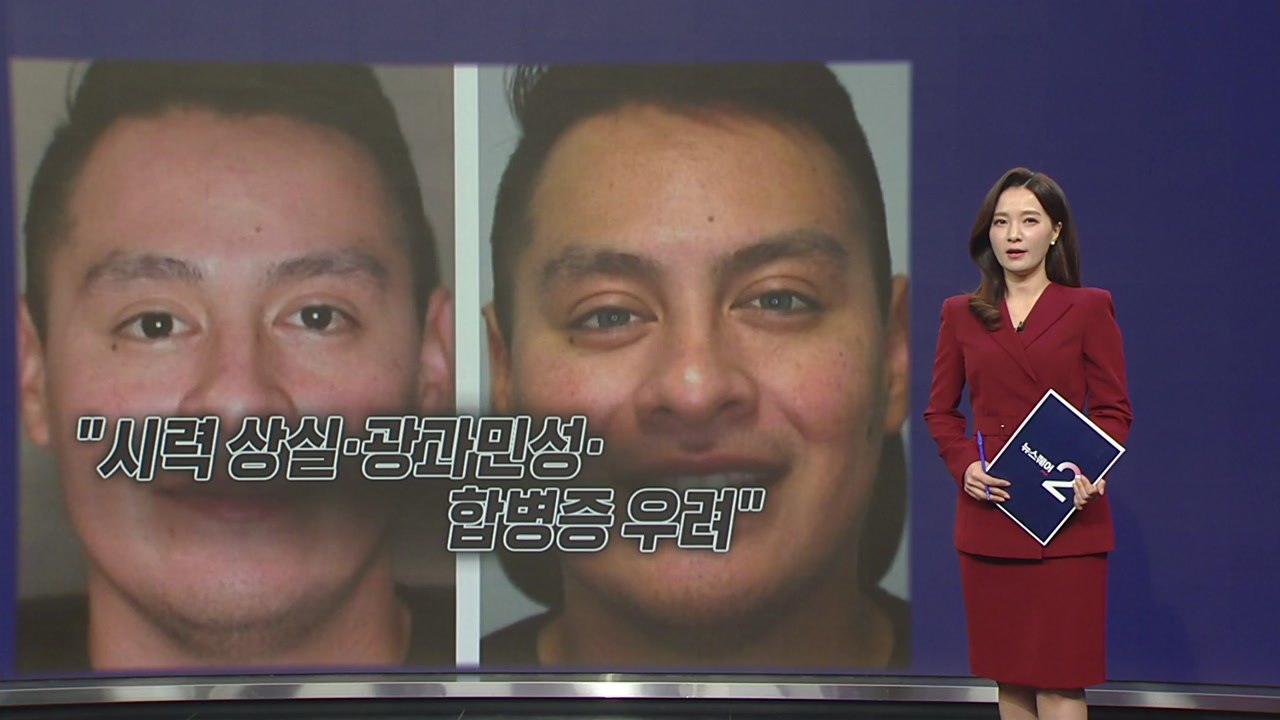 미국에서 '눈동자 색 바꾸는 수술' 인기...전문가 "부작용 주의" [앵커리포트] /...