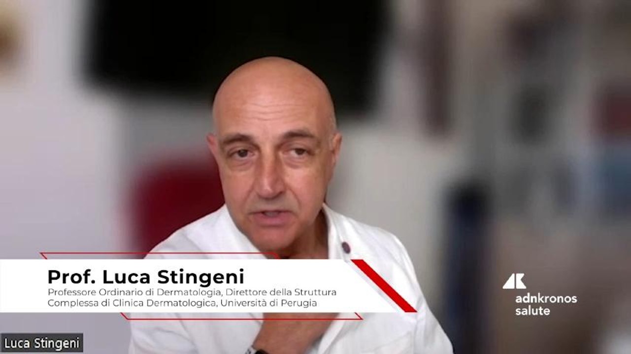 Stingeni (Univ. di Perugia): "Si stima che la prevalenza 'life-time' dell'eczema cronico delle mani sia pari al 15%"