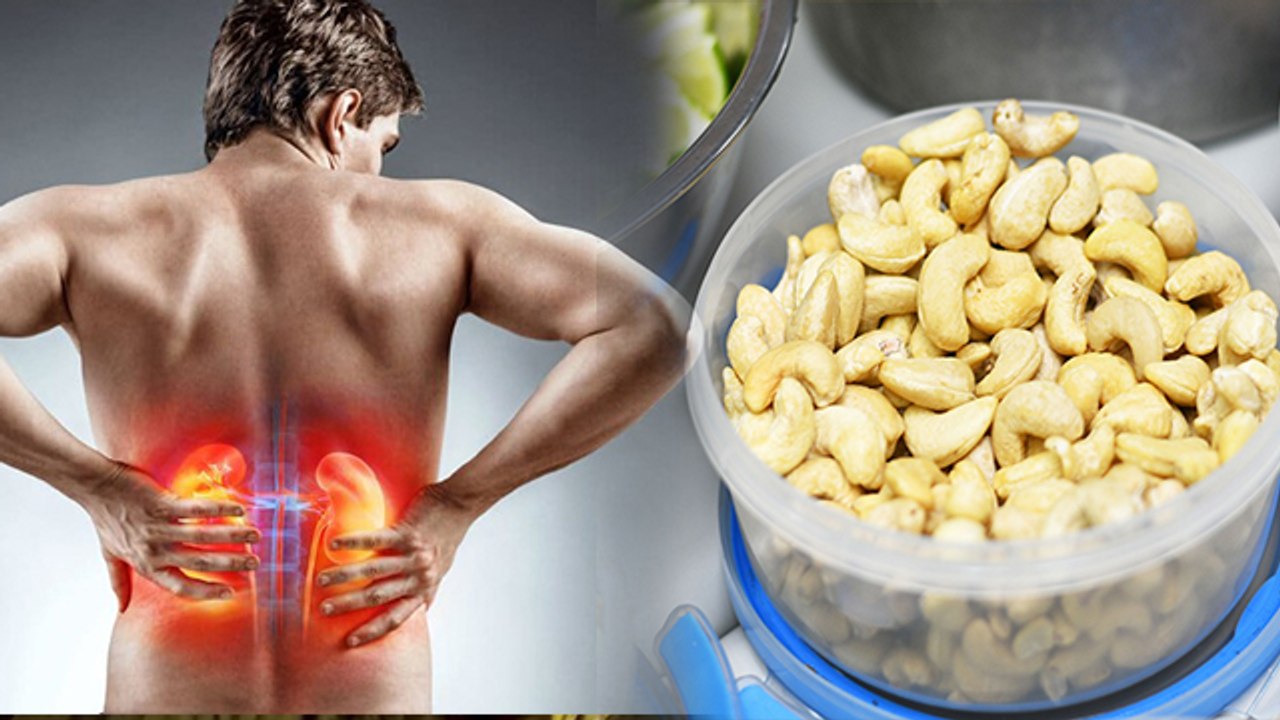 Cashew Side Effects In Hindi: 1 दिन में काजू कितना खाना चाहिए | Kaju Khane Ke Nuksan | Boldsky