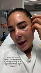 ¡Negligencia de Telemundo provoca accidente a 3 artistas!