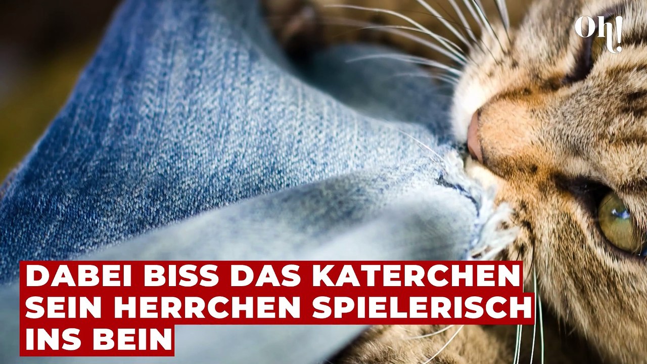Vom Haustier überrascht: Musiker erleidet schwere Verletzungen nach Treppensturz durch Katzenattacke