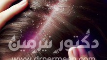 علاج قشرة الشعر #علاج #قشرة #قشرة_الرأس #قشر #الشعر #الرأس #فروة