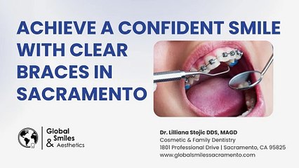 Achieve a Confident Smile with Clear Braces in Sacramento