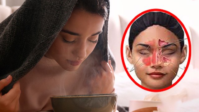 Burning Nose Relief: Naak Me Jalan Kyu Hoti Hai| नाक में जलन का इलाज...