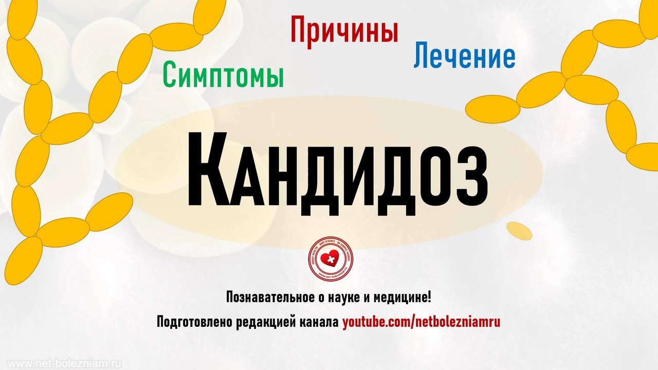Что такое микоз? Причины, симптомы и лечение кандидоза