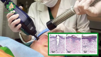 Cách chăm sóc da sau laser giúp da hồi phục nhanh chóng