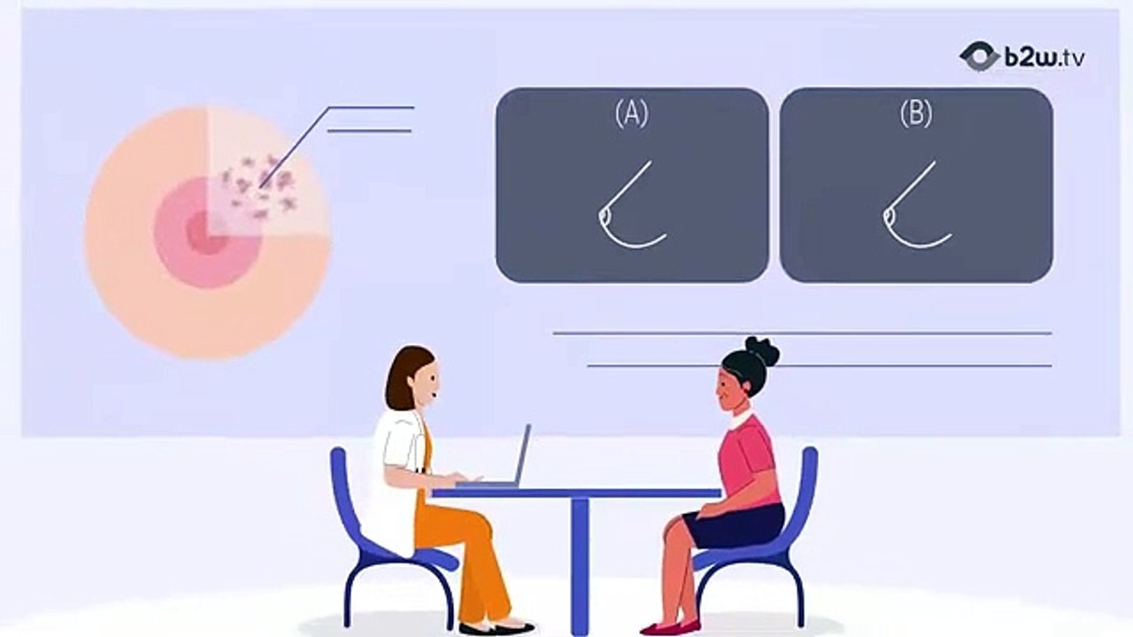 Healthcare Explainer Video on Early Cancer Detection for Prospect Medical