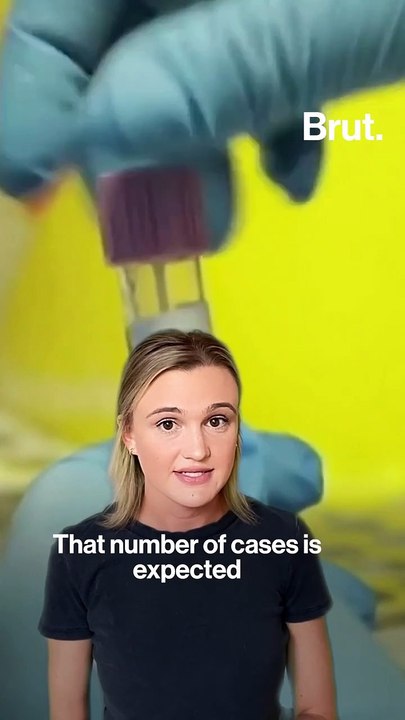 Monkeypox are officially a global health emergency, according to the World Health Organization. Let us explain …