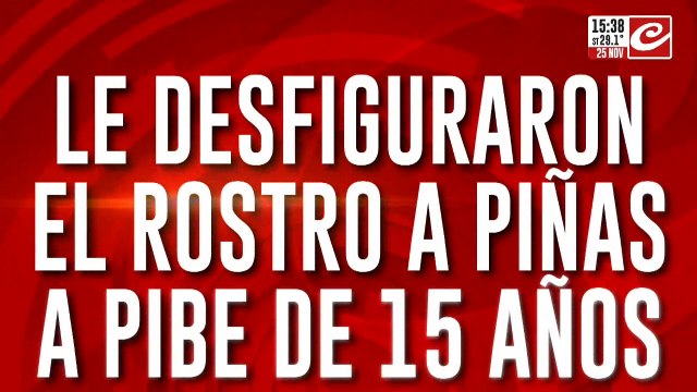 Le desfiguraron el rostro a piñas a pibe de 15 años: allanan la vivienda de un familiar del prófugo