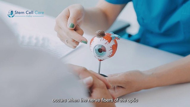 Exosome Treatment For Optic Nerve Atrophy | Stem Cells | Exosome |