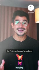 Vous connaissez l'étrange syndrome de Marcus Gunn ?