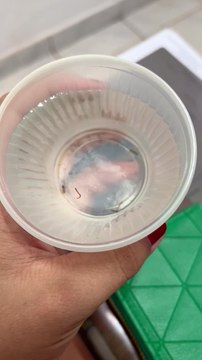 Água de UBS 10 em São Sebastião está contaminada por larvas