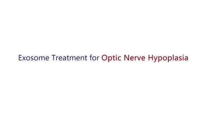 Exosome Treatment For Optic Nerve Hypoplasia | Best Stem Cell Center For Eye Disease |