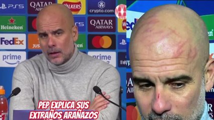 Guardiola con Graffi sul Volto: La Strana Ricostruzione dell'Incidente 😮