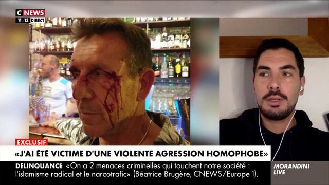 EXCLU - En larmes, Rémi, victime d'une agression homophobe, craque dans Morandini Live : Je n'ose plus sortir de chez moi. Ils ont été remis en liberté et j'ai peur de les croiser - Regardez