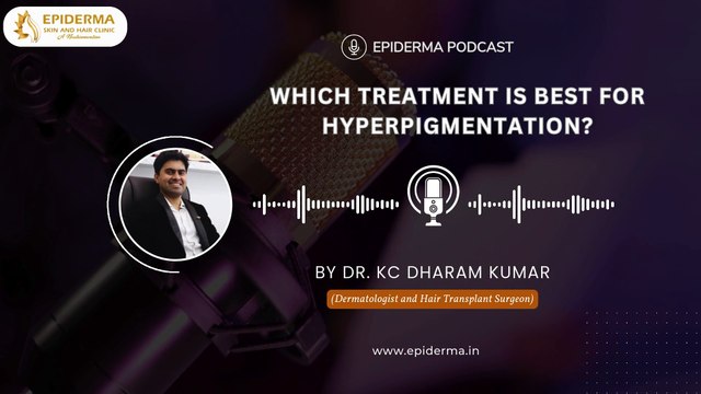 Podcast: Treatment For Hyperpigmentation | Best Skin Clinic in Jayanagar Bangalore | Epiderma Clinic