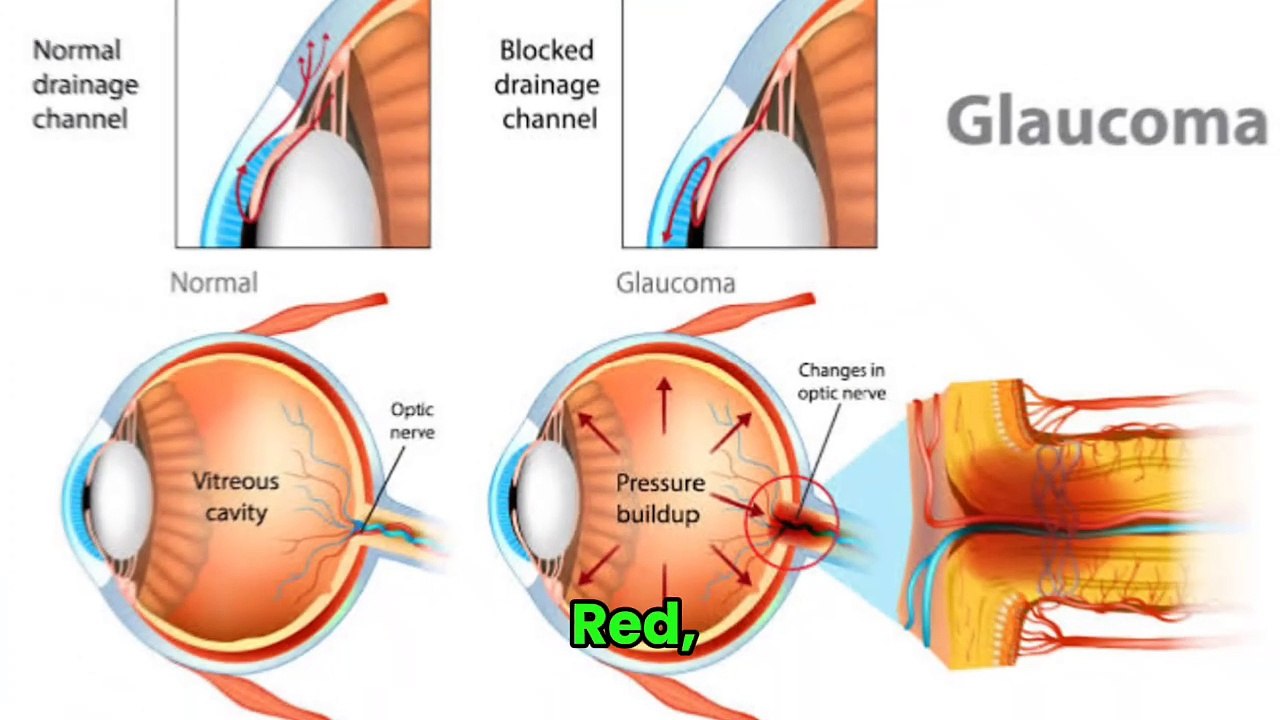 Top 14 Reasons for Blurry Vision and How to Fix Them!