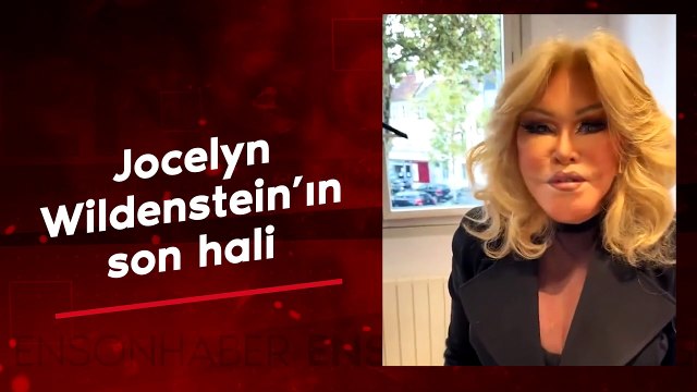 Kedi Kadın Jocelyn Wildenstein'ın son hali görenleri şaşırttı