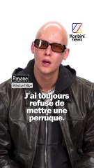 Alopécie: il a toujours refusé de porter une perruque