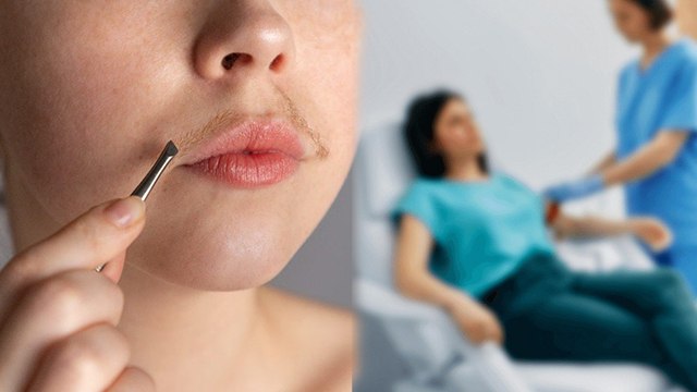 Chin Par Baal Kyu Aate Hai | Kis Hormone Imbalance Ki Vajah Se Facial Hair Ate Hai...