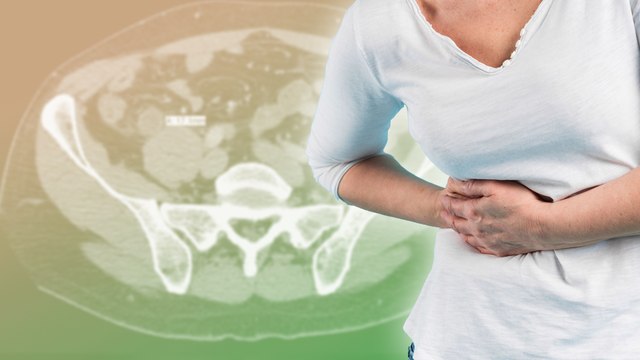 Viêm ruột thừa: Cơn đau bụng tưởng nhẹ nhưng có thể gây nguy hiểm đến tính mạng của bạn!