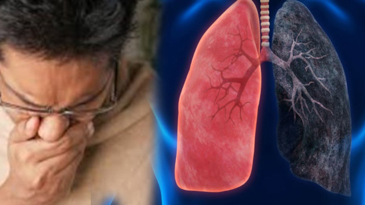Lungs Cancer Reason: Lungs Cancer Kyu Hota Hai, Air Pollution, Smoking To Asthma..| Boldsky