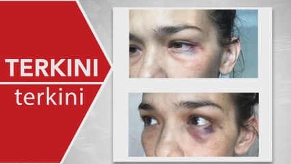 [TERKINI] Polis tahan suami bekas model, Zahnita Wilson