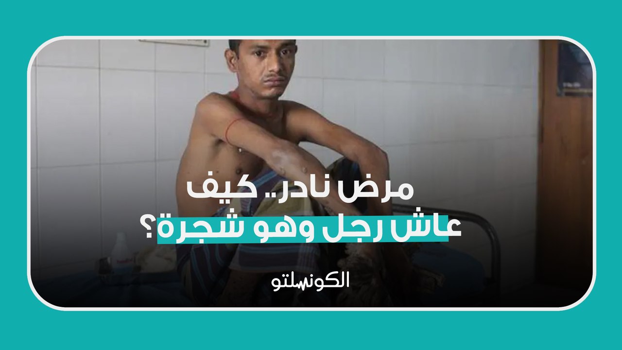 مرض نادر.. كيف عاش رجل وهو شجرة؟