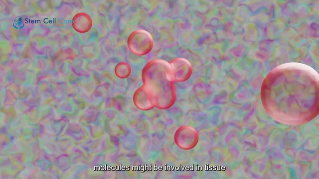 Exosome Treatment For Stroke | Neurological Disease | Stroke Treatment |