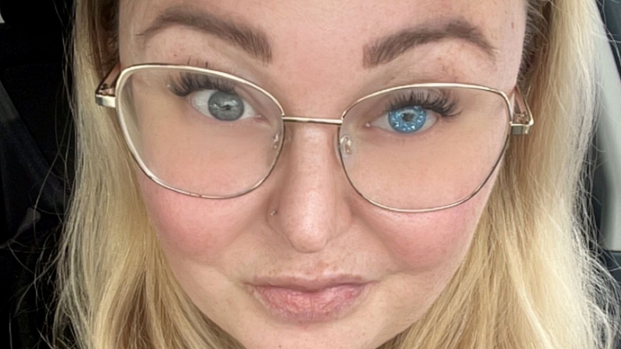 Mutter erhält glitzerndes falsches Auge, nachdem es ihr aufgrund einer seltenen Erkrankung entfernt werden musste