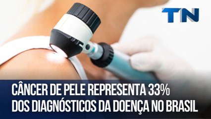 Câncer de pele representa 33% dos diagnósticos da doença no Brasil | Cuide-se Bem!