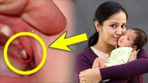 Epstein Pearls Causes In Babies: Baccho Ke Gums Me Safed Spot Hone Se Kya Hota Hai | Boldsky