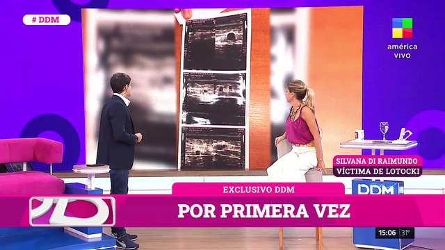 🔴 ANÍBAL LOTOCKI: Habla OTRA VÍCTIMA que se operó en 2021 y todavía TIENE SECUELAS