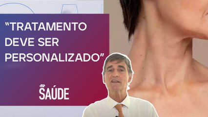 De que forma cirurgia na região cervical, deep neck, evoluiu? | Dr. Juvenal Frizzo