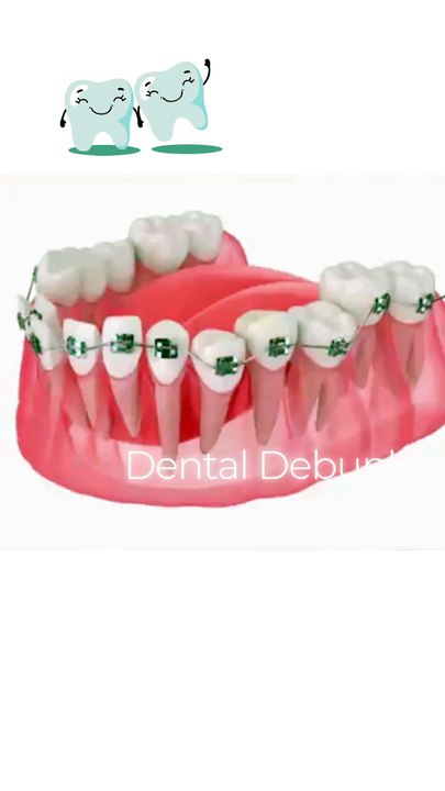 Tooth correction challenge